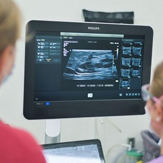 A medical ultrasound image displayed on a monitor during an examination, with two people viewing the scan in a clinical setting.